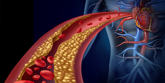 Boost Your Blood Flow, Get Your Memory Back